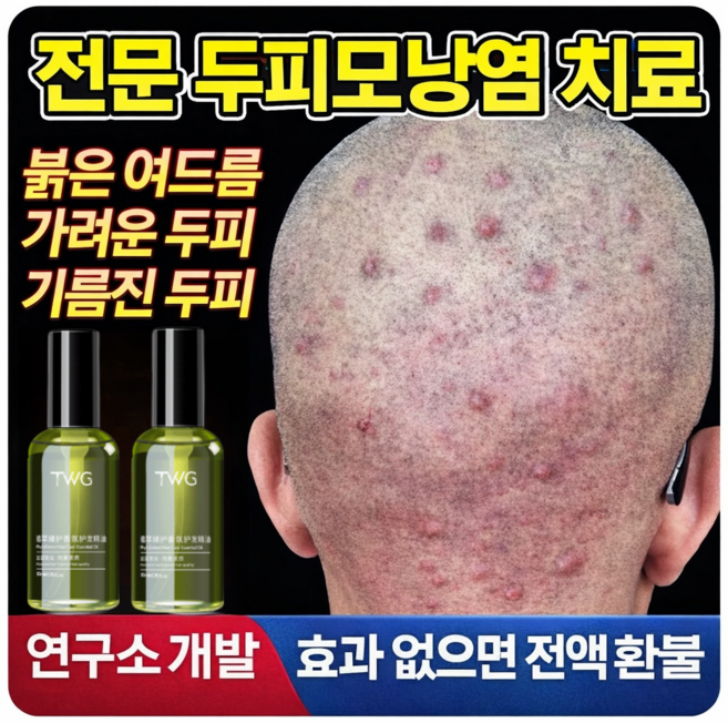 두피 모낭염 샴푸 머리 두피 가려움 여드름 뾰루지 트러블 지루성두피 모낭염 두피열 시카 진정토닉, 4개, 50ml