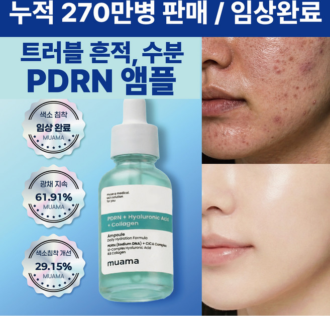 트러블 흔적 수분 진정 앰플 트러블 자국 피부결 광채 색소침착개선 임상완료 [누적 270만병 판매] 물광피부 PDRN 앰플 뮤아마 PDRN 히알루론산 콜라겐 앰플, 1개, 30ml