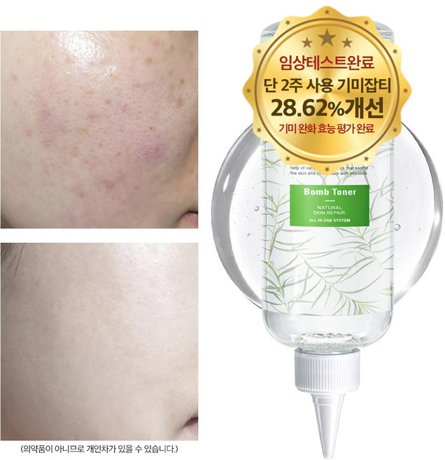 나이아신아마이드 토너 비타민 티트리 미백 기미 잡티 색소침착 착색 수분 보습 모공, 1개, 500ml