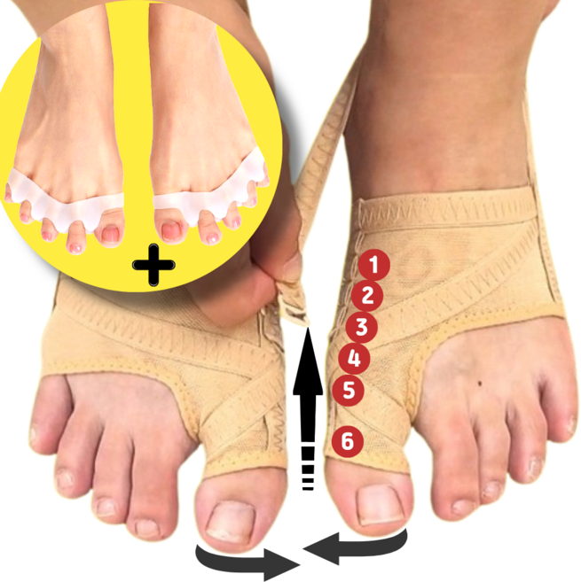 토어핏 엄지발가락 조절기 통증없는 단계조절 메쉬소재 좌우2개, 1세트