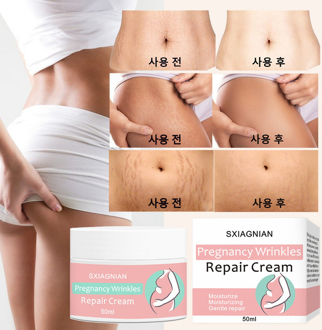 5위 - (한국셀러/본토출하) 산전후 튼살 생장문 탄력케어 크림 임산부 튼살크림 / 산전 산후 임산부 청소년기 일반인