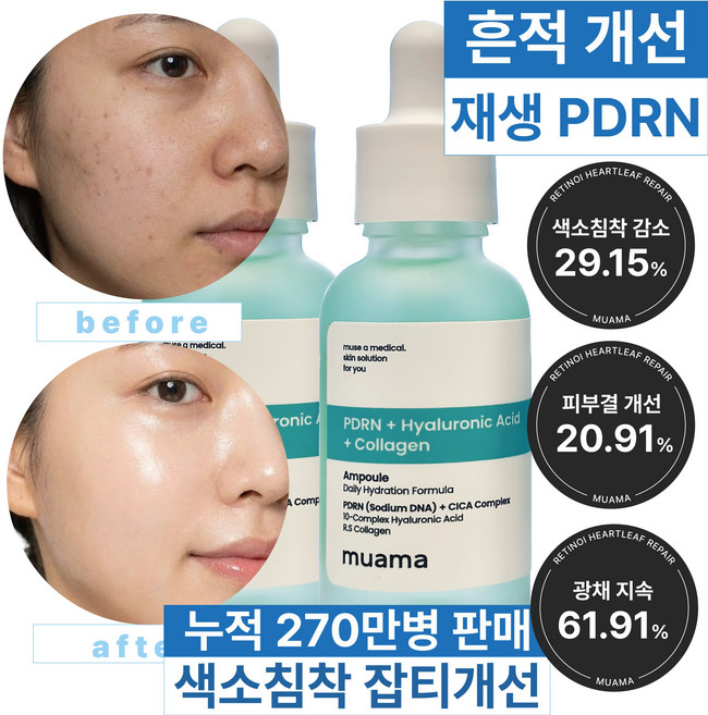 흔적 잡티 임상 트러블 흉터 수분폭탄 물광피부 재생 PDRN 히알루론산 케어 [색소침착 광채지속 피부결개선 임상 완료] 뮤아마 PDRN 히알루론산 콜라겐 앰플, 2개, 30ml