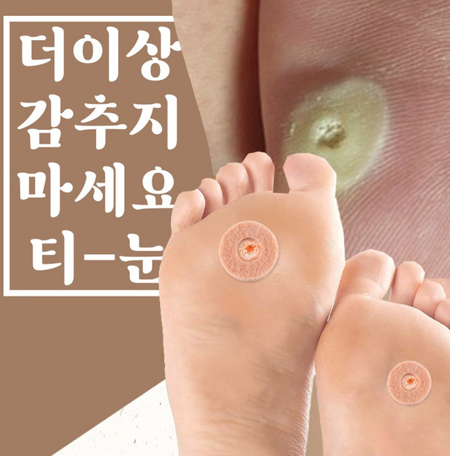 프로그인스페이스 티눈 보호 패치 발바닥 상처 통증 밴드, 1세트