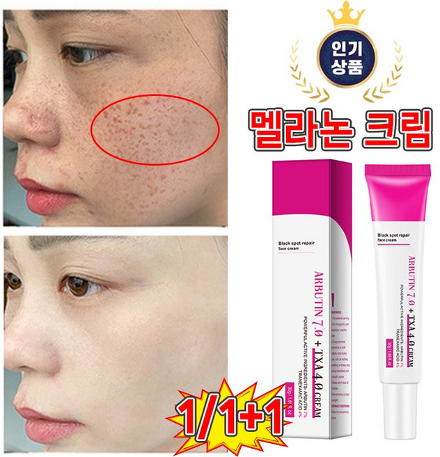[특별세일] 함익병 멜라논 크림 기미잡티 제거 크리1위 검버섯 색소침착 미백 크림 피부과 추천 4.0 CREAM, 1개, 30g