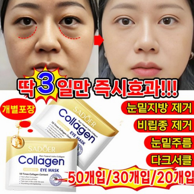 [국내배송] 50개/30개20개/ 눈밑지방 제거 아이 패치 아이백 다크서클 눈밑꺼짐 눈밑주름 제거 팔자 주름개선 패치 아이케어 포장 증정, 3개, 10개입