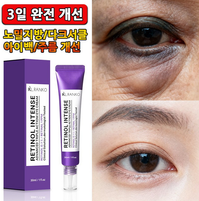 [주름개선 기능성] 눈가 주름 케어 아이크림 모이스처 라이징 크림 울쎄라블 리프팅 900샷아이크림, 30g, 1개