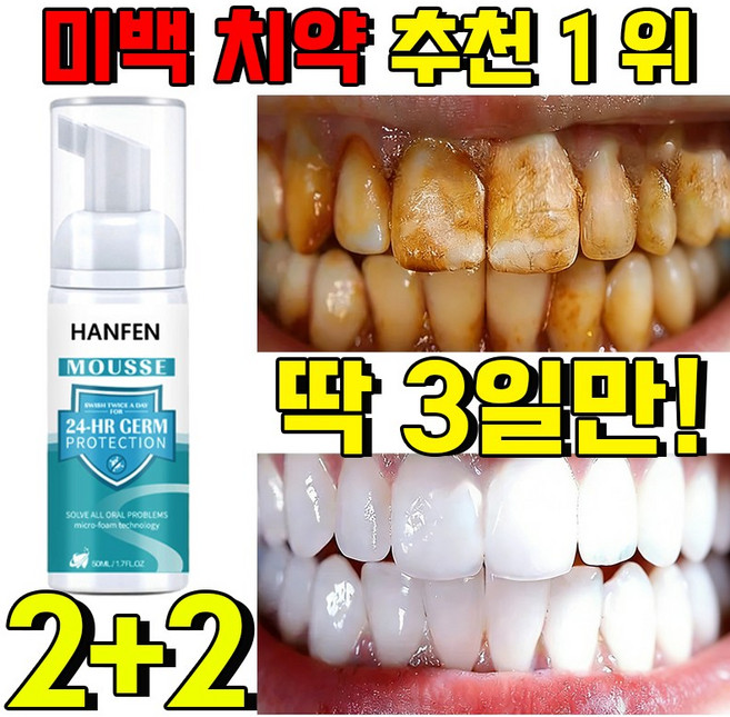 1+1 누렁니 미백 치약 추천 1 위 화이트닝 치약 하이드록시아파타이트 치약 잇몸 치약 누렁니 미백 치약 화이트닝 치약 저불소 천연 구취 입냄새 제거 치아 미백, 4개, 50ml