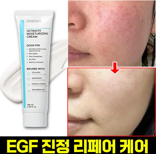 고함량 EGF 재생크림 진정 시카 크림 주름개선 피부 붉은기 보습 병풀 재생 크림 피부장벽강화 PDRN 콜라겐 크림 포장증정, 1개, 100ml