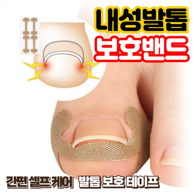 리치캣 내성발톱 교정 테이프 보호 밴드 시트, 40개