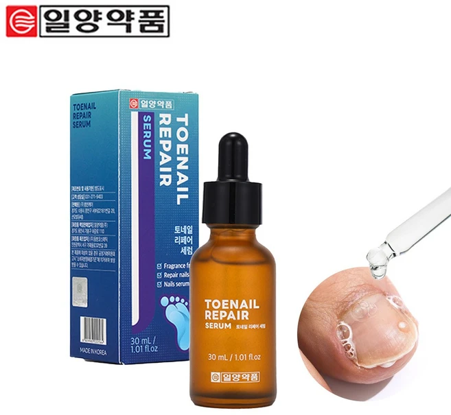 일양약품 문제성 손발톱 전문 리페어 세럼 영양제 토네일 문제성발톱, 1개, 30ml - 쿠팡