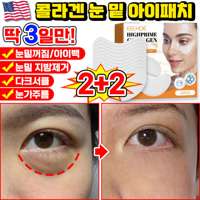 [당일출고] 미국기술 10/10+10/20+20 콜라겐 아이패치 눈밑 지방제거 패치 다크서클 눈밑꺼짐 제거 아이팩 눈가주름 패치 아이백 리프팅 아이케어 사은품 랜덤 증정, 4개, 10개입