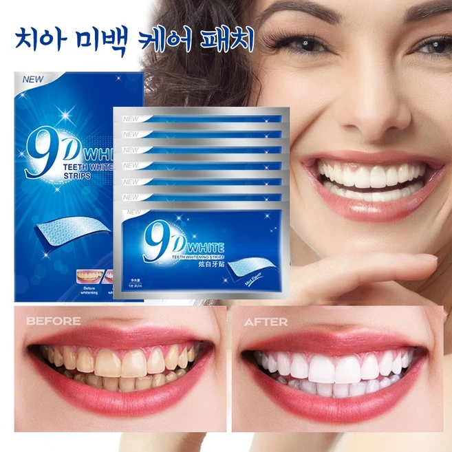치아 미백 패치 화이트닝 스트립 누런이 관리 셀프 치아 미백 9D 미백 14pcs, 3개 - 쿠팡