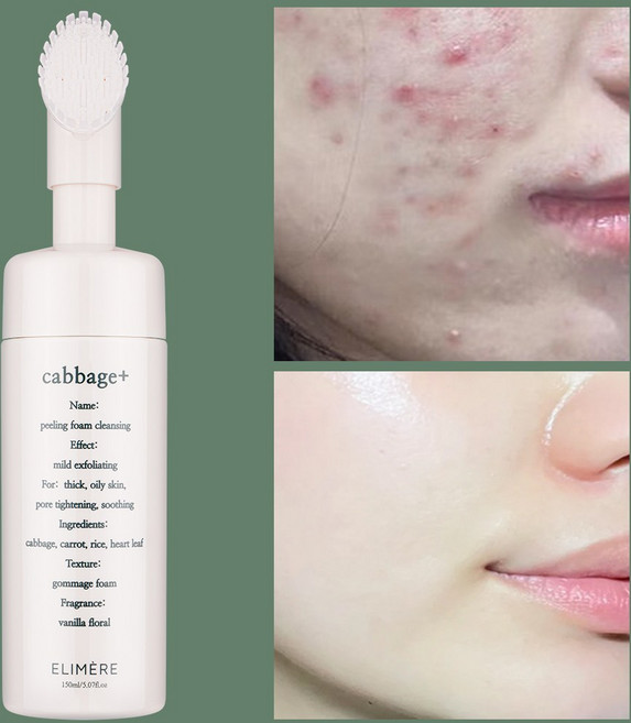캐비지 필링 얼굴각질제거 폼클렌징 150ml, 1개