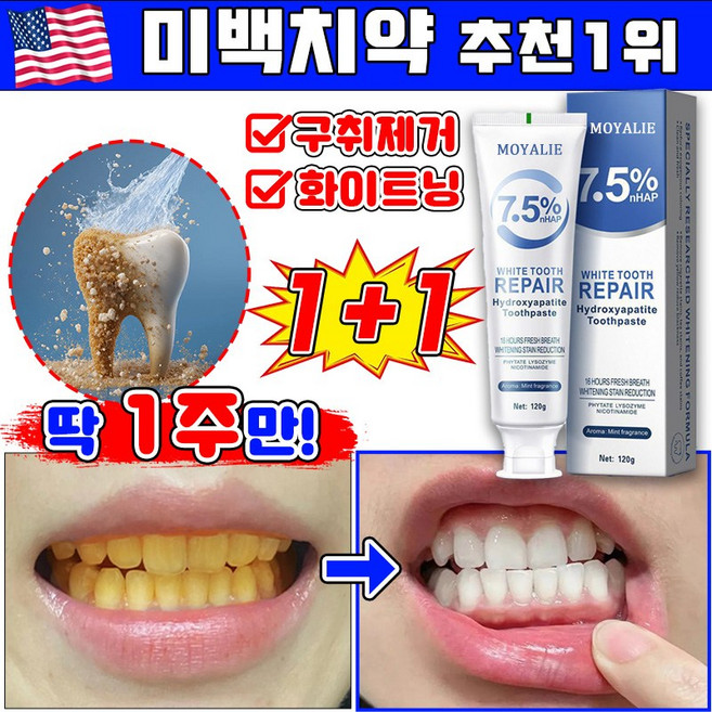 미백 치약 추천1위 미백치약 치약미백 누렁니 미백 치약 화이트닝 치약 치아 미백치약 입냄새제거 구취제거 치아미백 누렁니제거 치석제거 LUPEIYA, 2개, 120g