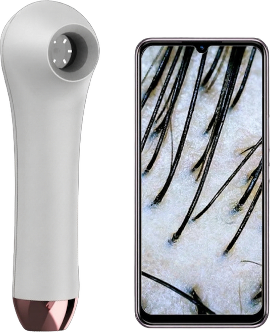 두피카메라 두피현미경 돋보기 핸드폰 연결 확대 렌즈 고화질 무선 1000X, -, 1개