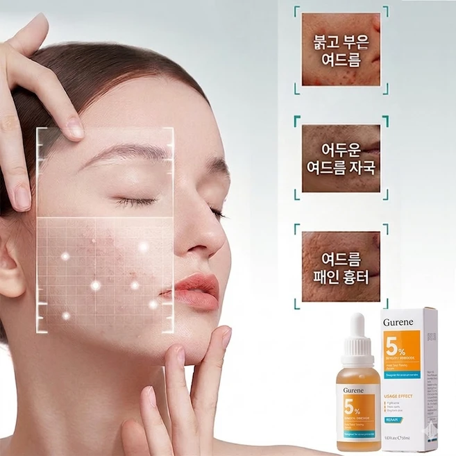 Gurene 5% 벤조일 퍼옥사이드 트러블 타겟팅 세럼, 2개, 30ml - 쿠팡
