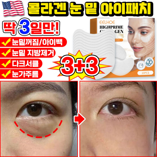 [당일출고] 미국기술 10/10+10/20+20 콜라겐 아이패치 눈밑 지방제거 패치 다크서클 눈밑꺼짐 제거 아이팩 눈가주름 패치 아이백 리프팅 아이케어 LUPEIYA 포장증정, 6개, 10개입