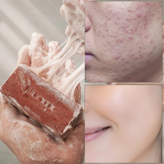 브릭커 피기 어성초 CP 천연비누 (무화과 고체팩), 104g, 1개입 - 쿠팡