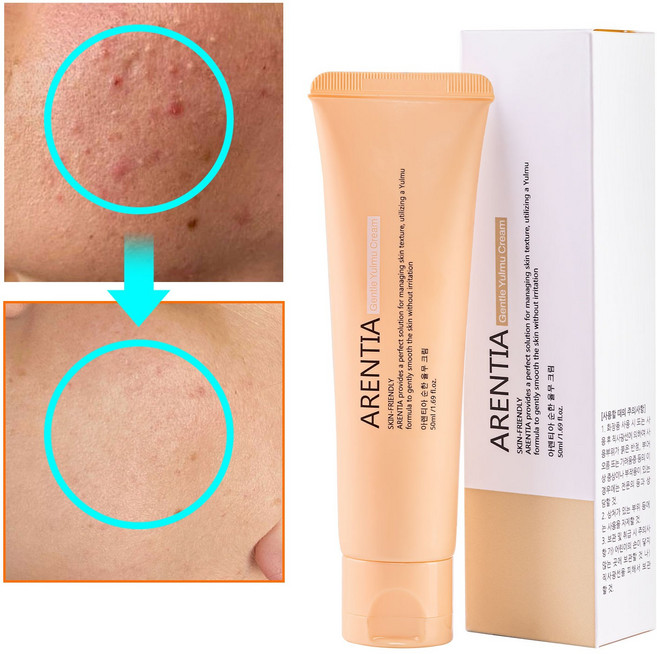 율무크림 율무 피부요철 율무영양크림 피부 오돌토돌 좁쌀 피부 요철 피부결개선 얼굴 눈밑 나비존 모공 비립종, 1개, 50ml