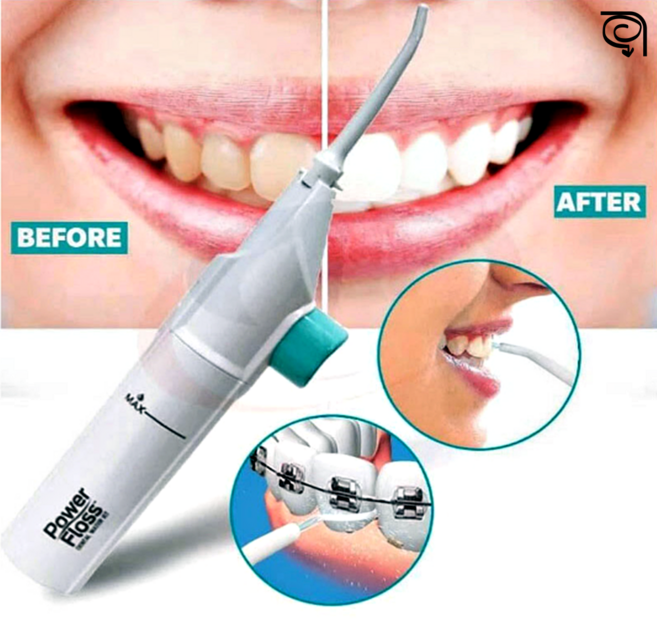 직수형 구강 세정기 치간 물치실 무선 워터 치아청소 물양치rul-30, E파워FLOSS구강세정기