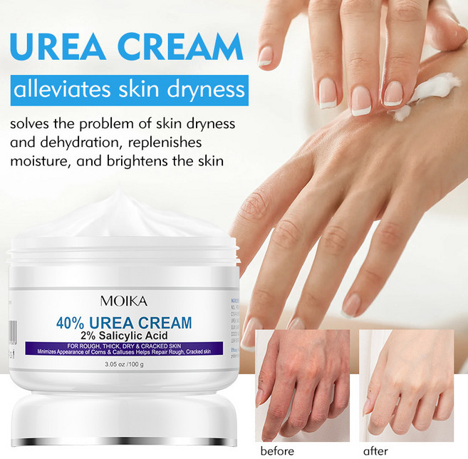 DERMFREE 유리아 크림 고보습 우레아 크림 풋크림 유레아 크림 뒷꿈치 유리아 요소 크림 피부연화제 유리아크림 각질 보습, 2개, 100ml, 2개입