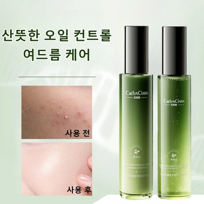 워터밸런스 스킨 로션 세트 여드름화장품 지성 피부 트러블 진정 스킨 화장품 여드름 진정 케어 토너115ml+ 로션 115ml 세트, 여드름 토너+로션, 2세트 - 쿠팡