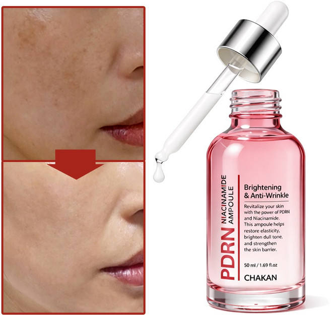 기미 잡티 주근깨 보습 모공 피디알엔 PDRN 나이아신아마이드 앰플, 1개, 50ml