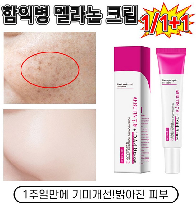 [당일출고] 1/1+1 멜라논 크림 함익병 기미잡티 제거 색소침착 미백 크림 고농축 흑자 집중개선 극추천ARBUTIN 7.0, 1개, 30ml