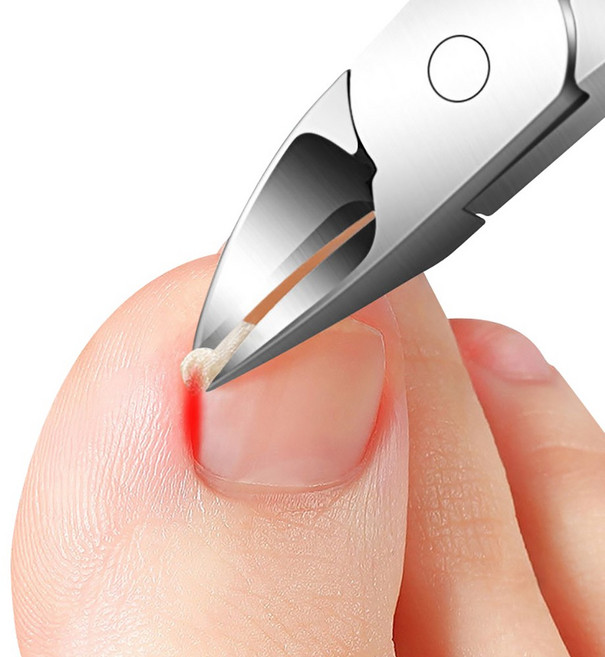 할인바이할인 뾰족 매부리 예리한 손톱/발톱깎이 문제성 발톱깎이, 1개, 블랙