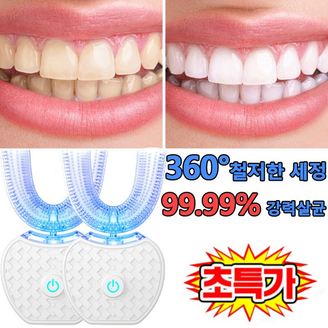 풀형 미백 치아 미백기 u자형 전동칫솔 음파전동칫솔 강력살균/360도, 핑크, 2개, SA-VW-520