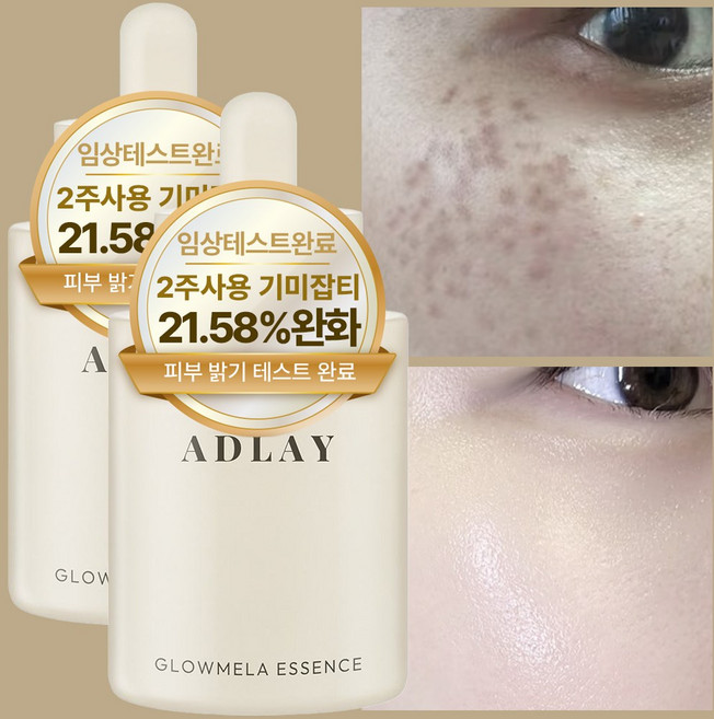 아들레이 화이트닝 색소침착 기미 미백 에센스 앰플, 2개, 50ml