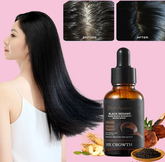 헤어 영양제 검은깨 두피케어 모발 성장 헤어라인 구렛나루 촉진제 비오틴 모낭 보습 비오틴 로즈마리 에센스, 3개, 30ml - 쿠팡