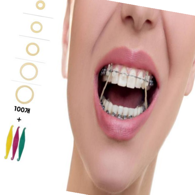루체트리 교정고무줄 착용 5size 100개 치아 셀프 교정기 구강용품