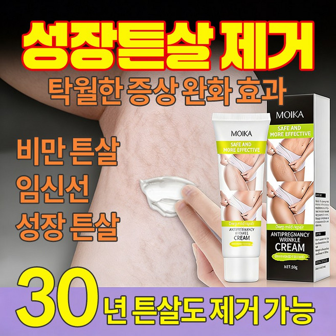 산후 임신주름 제거 비만주름 청소년 성장주름 케어 크림, 1개, 50g
