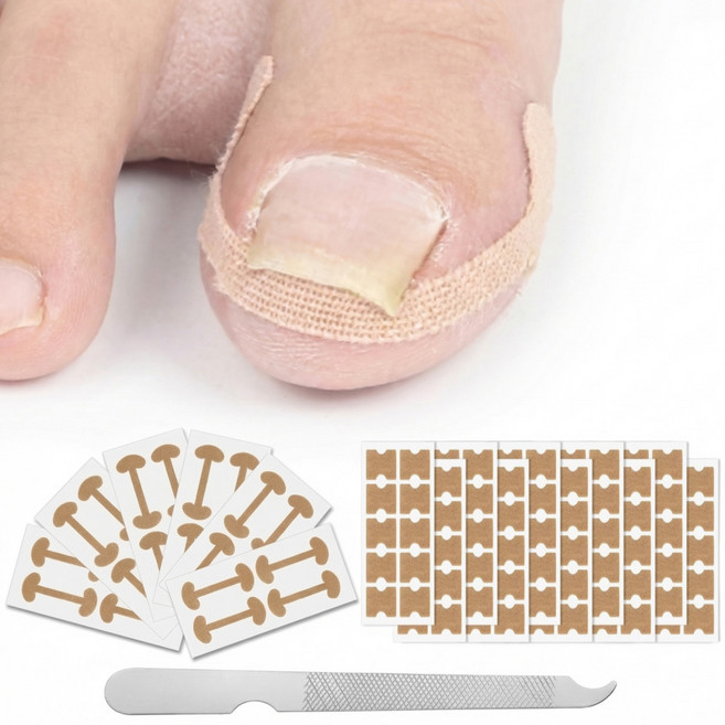 혼자서 1분 내성 발톱 테이프 밴드 2+1 (큐렛 포함), 1세트