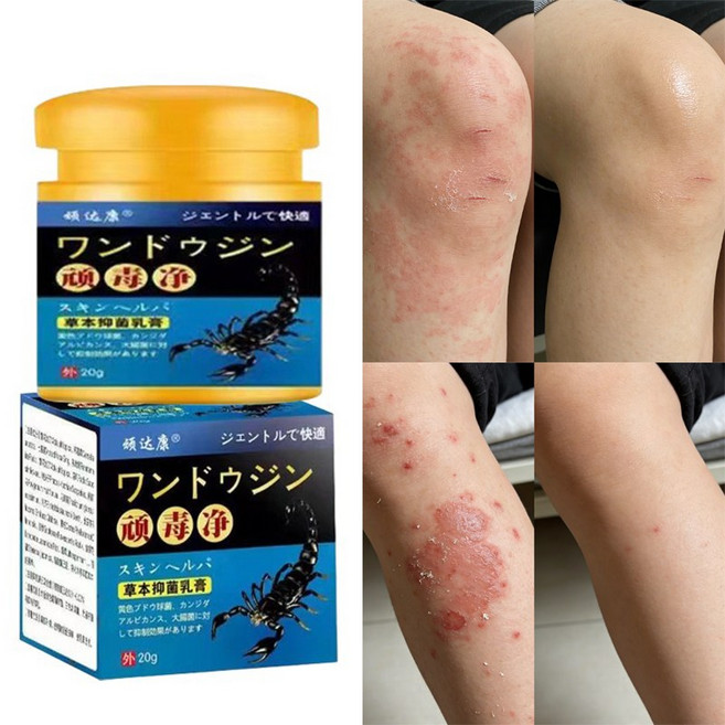 즉각 가려움 완화 피부 진정 멀티 밤 피부염 케어 크림, 1개, 20g