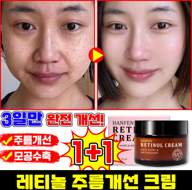 [100% 효과있음] 레티놀 크림 모공수축 크림 주름개선 재생크림 탄력 리프팅 미백 크림 미간 팔자주름 링클케어 수분크림, 2개, 32g