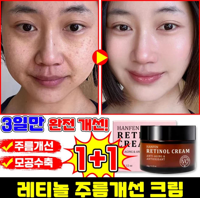 [100% 효과있음] 레티놀 크림 모공수축 크림 주름개선 재생크림 탄력 리프팅 미백 크림 미간 팔자주름 링클케어 수분크림, 2개, 32g - 쿠팡