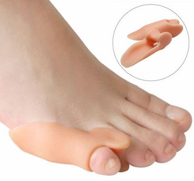 미즈코스 2p 새끼 발가락 교정기 벌리개 분리 서바나 링, 1세트, 베이지