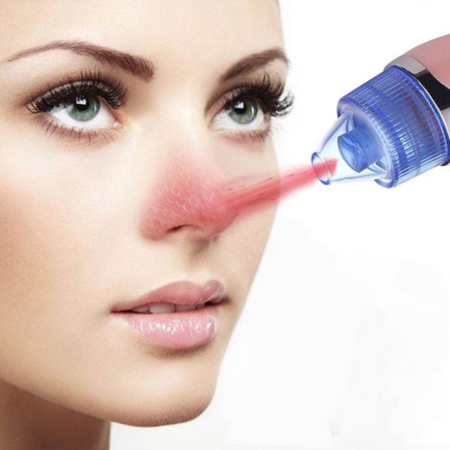 모공케어 블렉헤드 압출기 5단 전동 피지흡입기 white, 5단피지제거기 QL-605-핑크