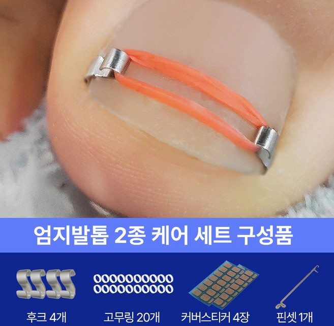 아임봄 파고드는 엄지발톱 압박을 덜어주는 케어템, 1개, 화이트