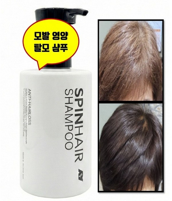 선물 )탈모 샴푸 1위 음이온샴푸 두피케어 올인원 모근강화 볼륨최고 식약청 허가 파격가(신제품기념), 2개, 500ml