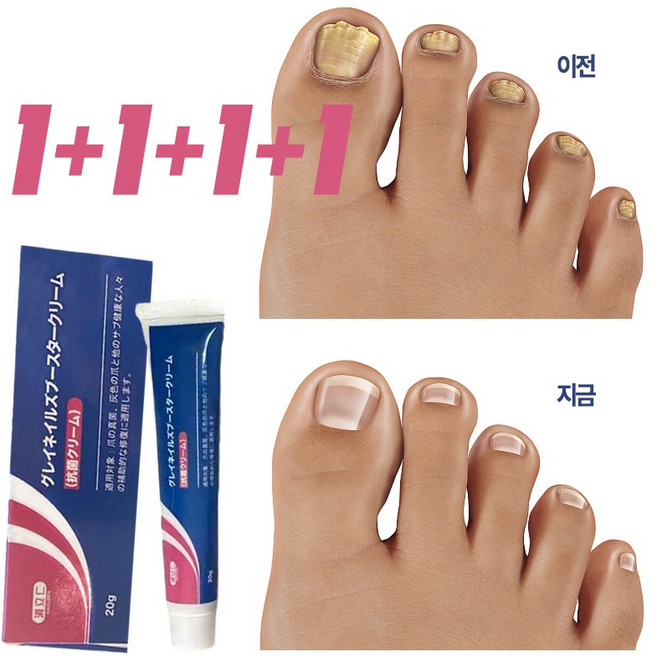 [국내배송] 솔루션 문제성발톱 앰플 발톱 곰팡이 한번에끝내는 손발톱 영양제 발톱 곰팡이 치료제, 20g, 4개, 1개입