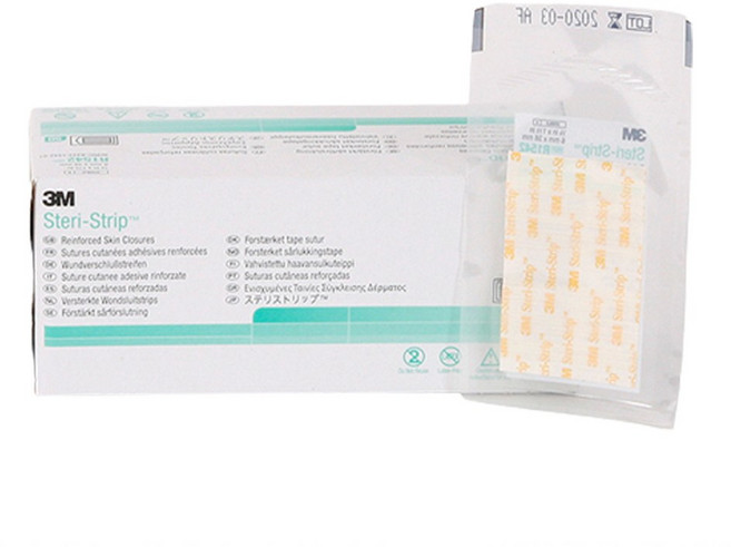 3M 스테리스트립 R1542 흉터밴드 상처 피부 봉합 수술 반창고 테이프, 1박스