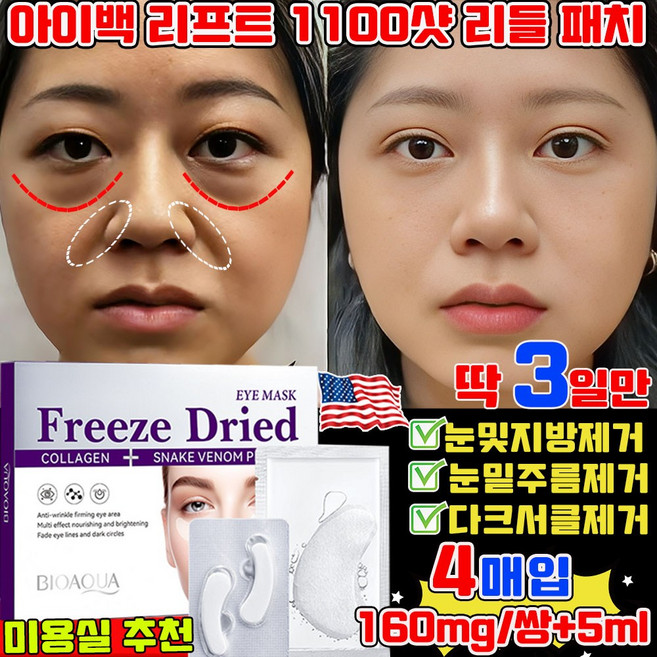 아이백 리프트 1100샷 리들 패치 눈밑 지방제거 패치 눈 밑 아이패치 니들 패치 눈밑주름 다크서클 눈밑꺼짐 개선 리프팅 패치 동결건조 아이백 사은품 랜덤 증정, 1개, 4개입