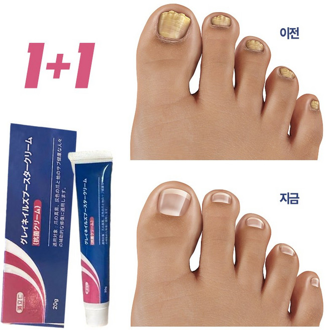 [국내배송] 솔루션 문제성발톱 앰플 발톱 곰팡이 한번에끝내는 손발톱 영양제 발톱 곰팡이 치료제, 20g, 2개, 1개입