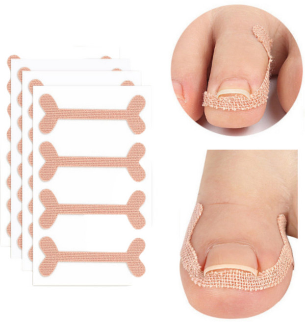 우아한클릭 내성발톱테이프 발톱 보호 밴드 40p, 1세트