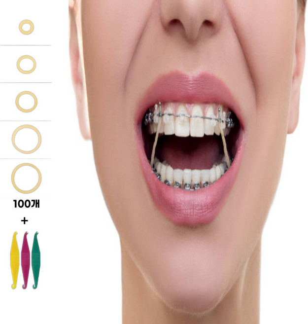 치아 교정고무줄 셀프 착용 교정기 5size [이 이빨 고무 링 밴드 100P], 7.9mm, 1개