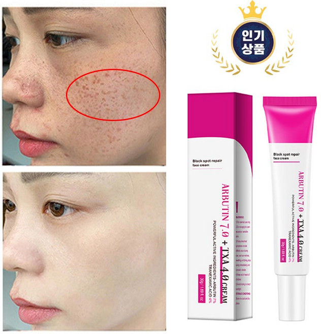 [특별세일] 함익병 멜라논 크림 기미잡티 제거 크리1위 검버섯 색소침착 미백 크림 피부과 추천 4.0 CREAM, 1개, 30g