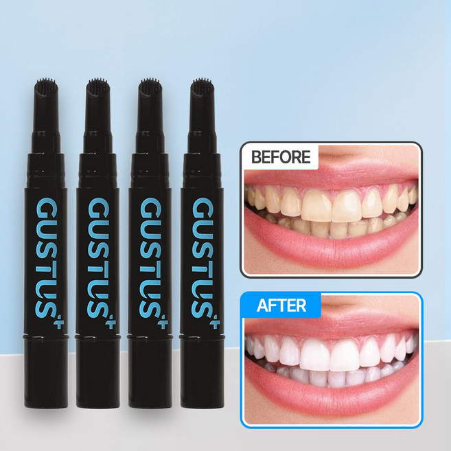 구스투스 치아미백겔(과산화수소 35%) 셀프 치아미백 기계 미백기 화이트닝 겔, 4g, 4개